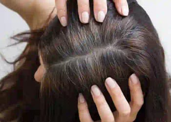 सफेद बालों