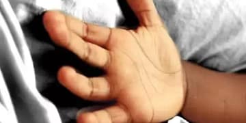 फूड प्वाइजनिंग