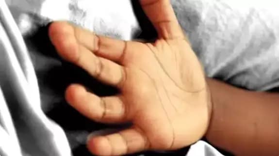 फूड प्वाइजनिंग