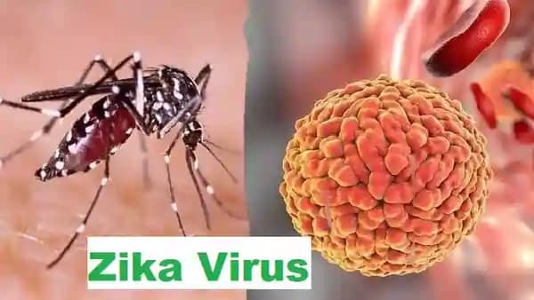 Zika Virus