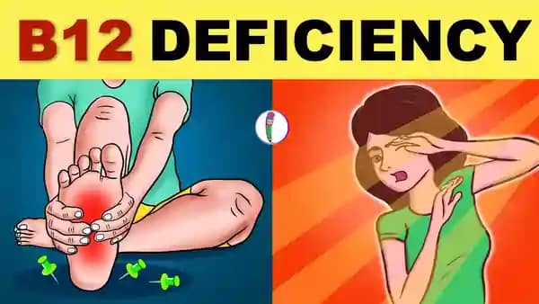 Vitamin B12 deficiency
