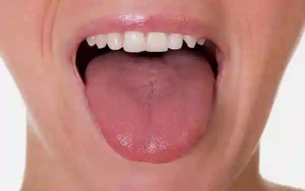 Tongue